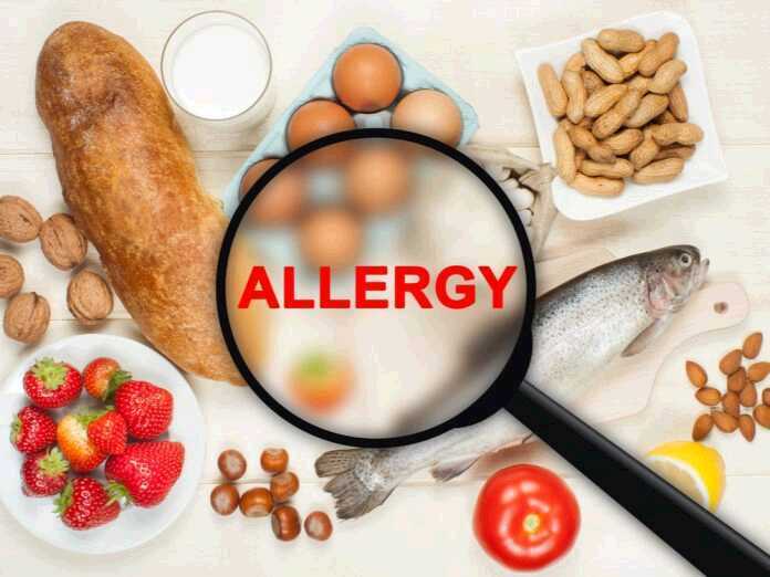 manage your food allergy